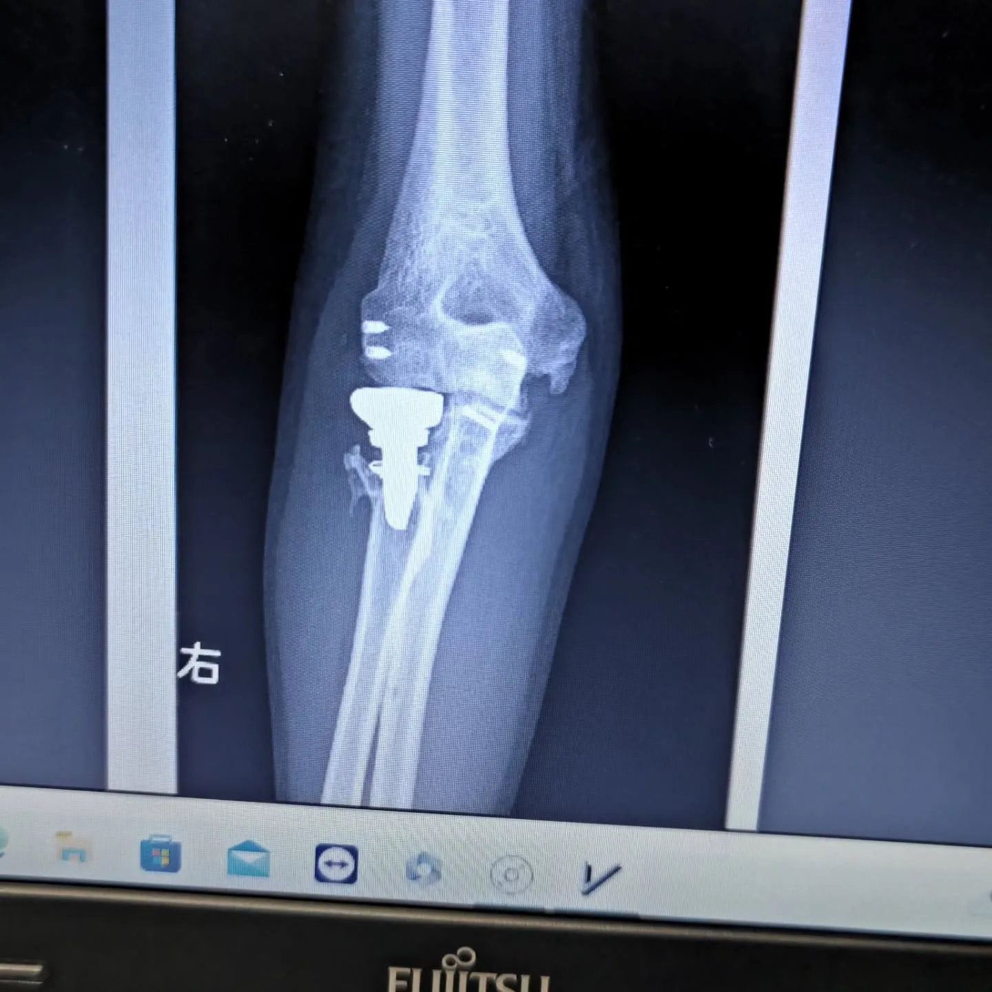 まだ開けてる、もう開けてる、ずっと開けてる